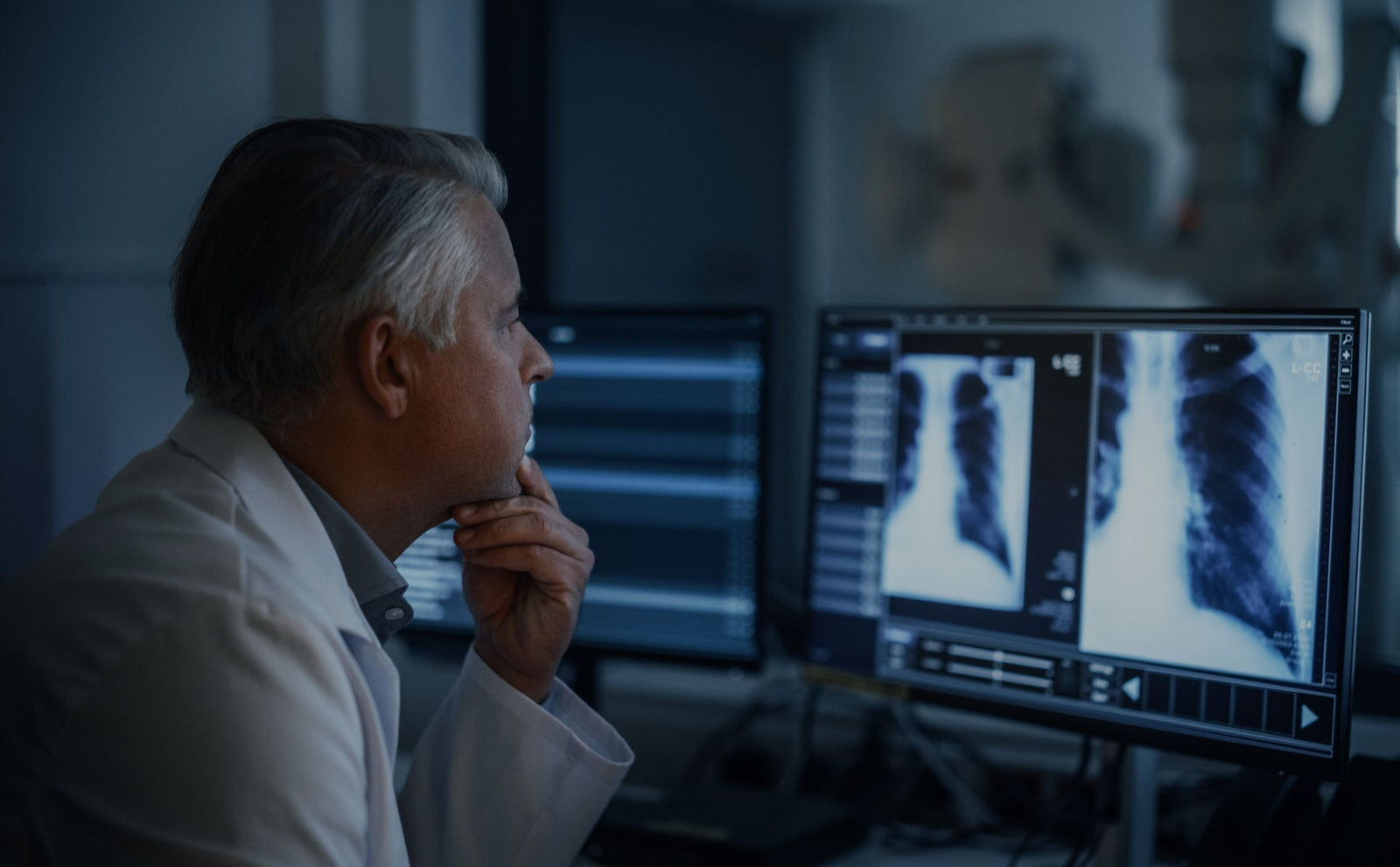 X-ray cassette cover ROI 2025